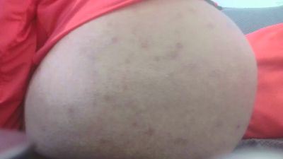 Lovely_one20 webcam model stream image