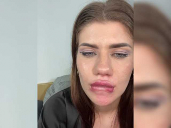 AlisaLex webcam bongacams model stream image
